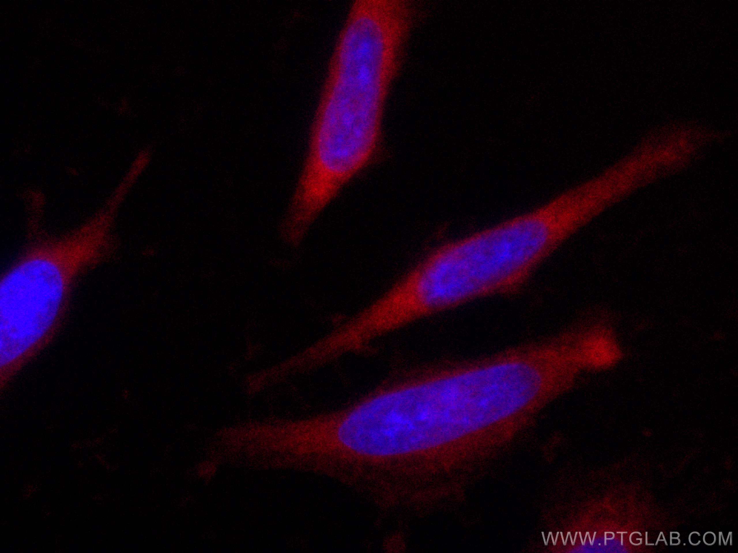 Immunofluorescence (IF) / fluorescent staining of HeLa cells using CoraLite® Plus 647-conjugated IkB Alpha Polyclonal (CL647-10268)