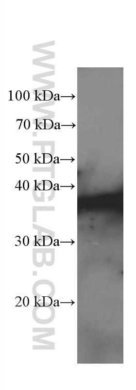 WB analysis of ROS1728 using 66418-1-Ig