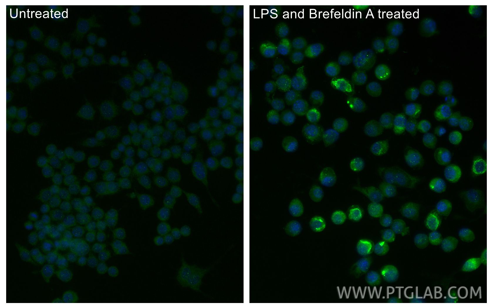 IF Staining of RAW 264.7 using 29530-1-AP Immunofluorescence (IF) / fluorescent staining of RAW 264.7 cells using IL-1 beta Polyclonal antibody (29530-1-AP)