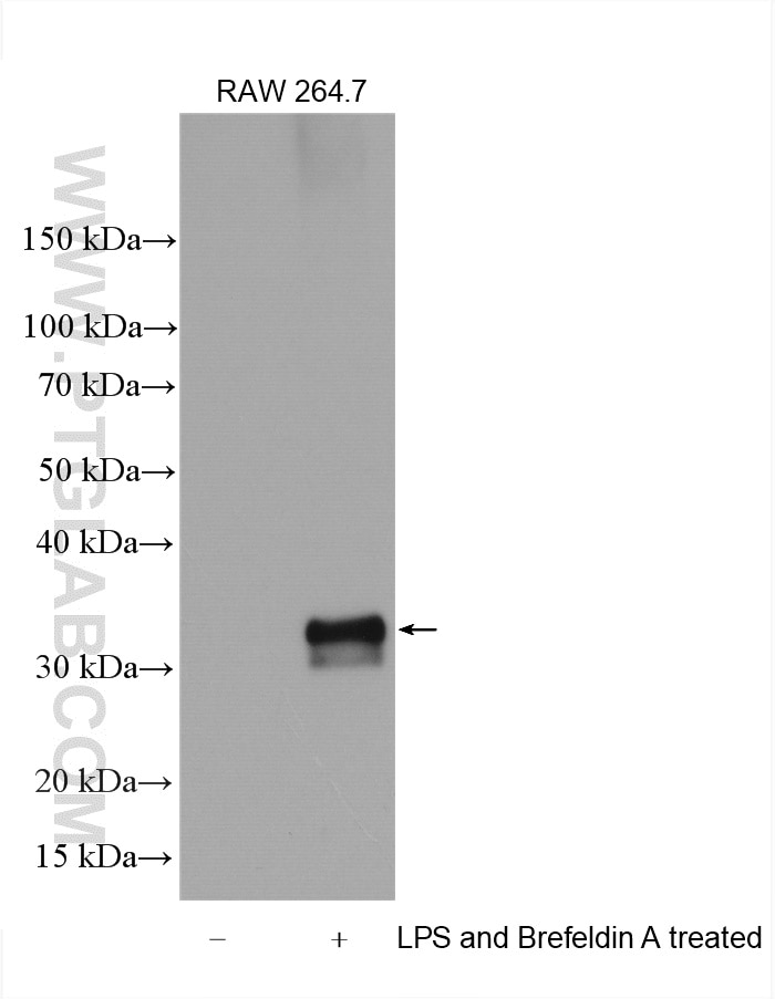 Western Blot (WB) analysis of various lysates using IL-1 beta Polyclonal antibody (29530-1-AP)
