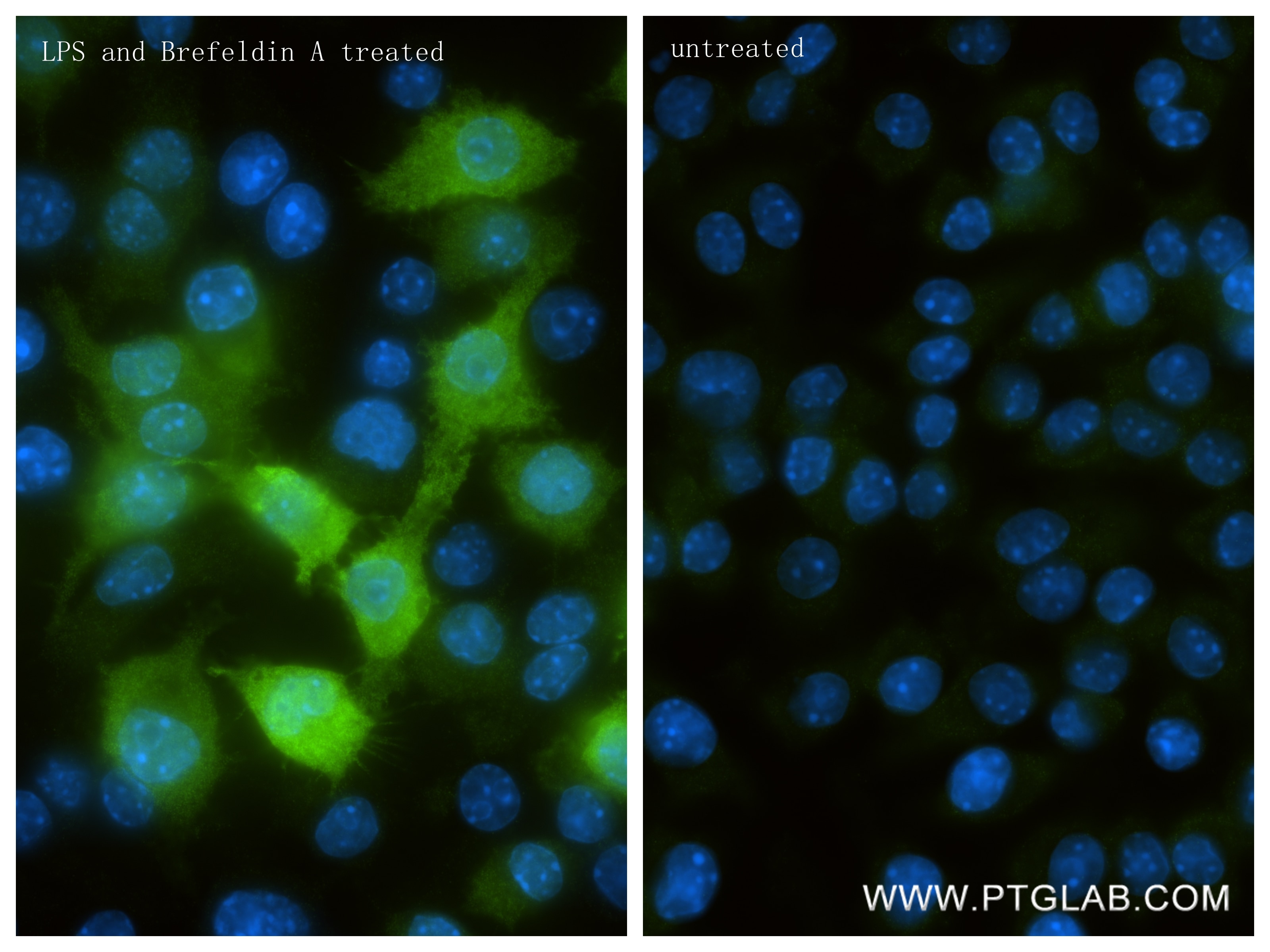 Immunofluorescence (IF) / fluorescent staining of RAW 264.7 cells using IL-1 beta Recombinant monoclonal antibody (84274-1-RR)