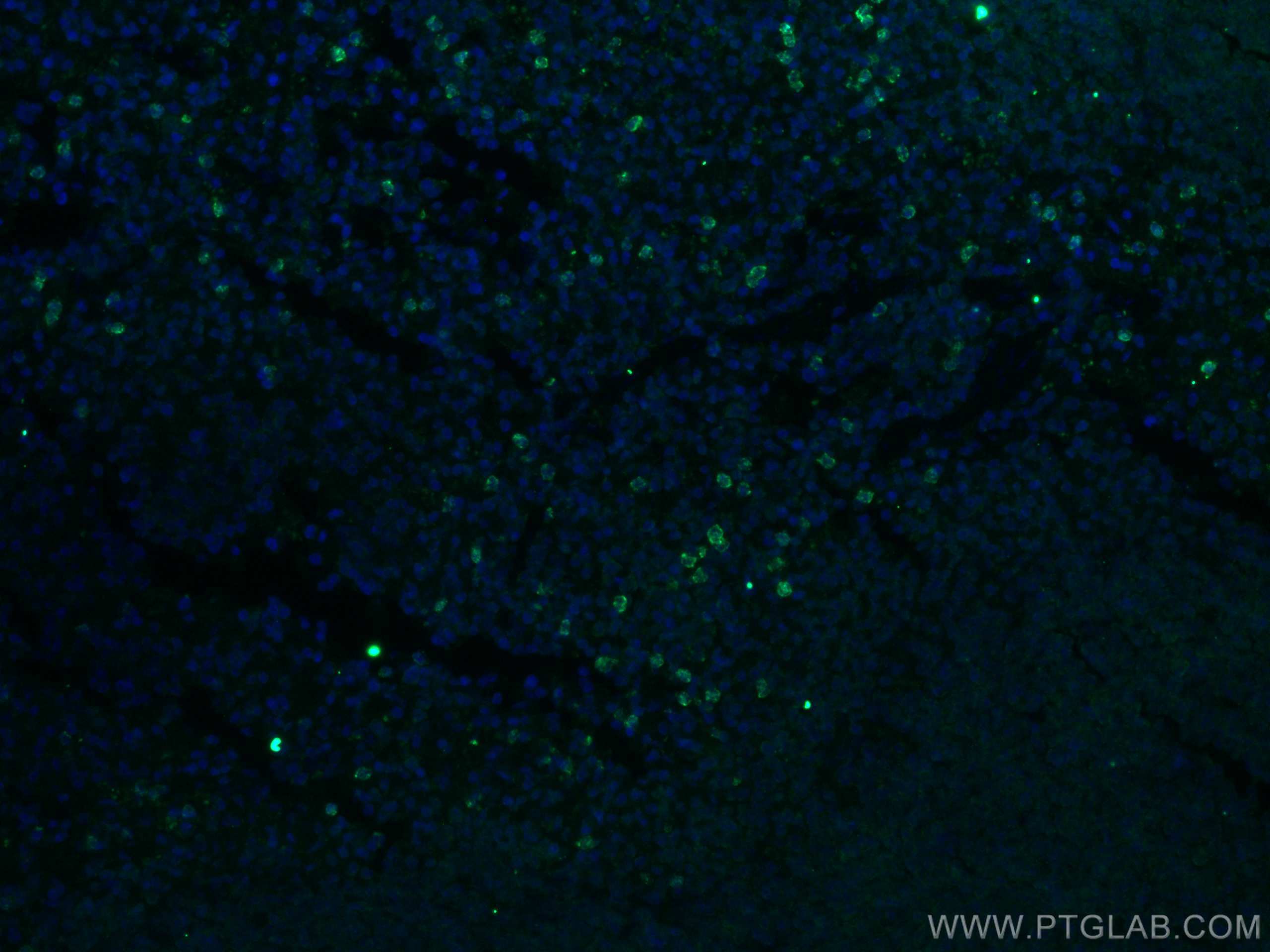 Immunofluorescence (IF) / fluorescent staining of mouse spleen tissue using IL-17a Polyclonal antibody (26163-1-AP)