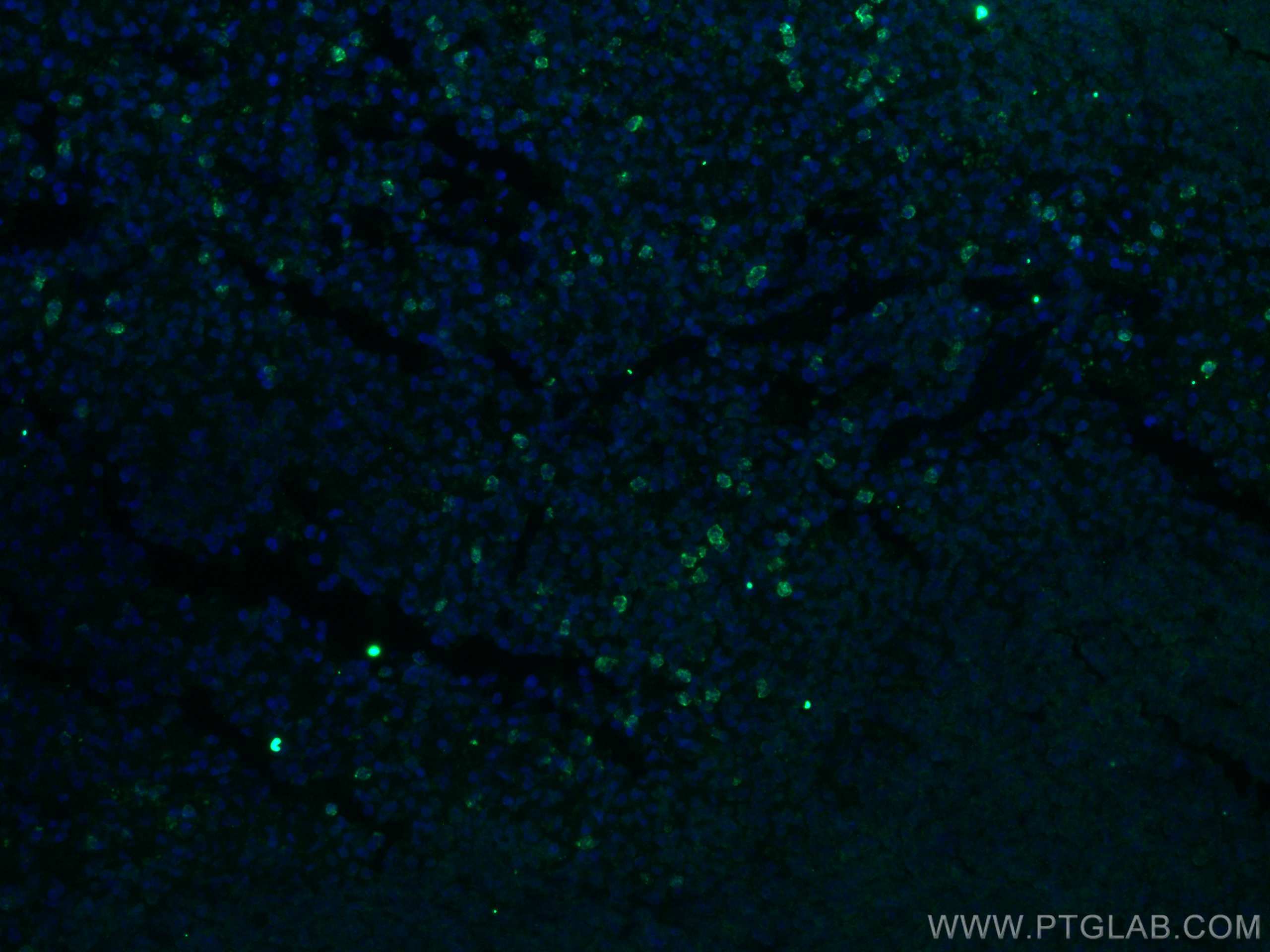 IF Staining of mouse spleen using 26163-1-AP