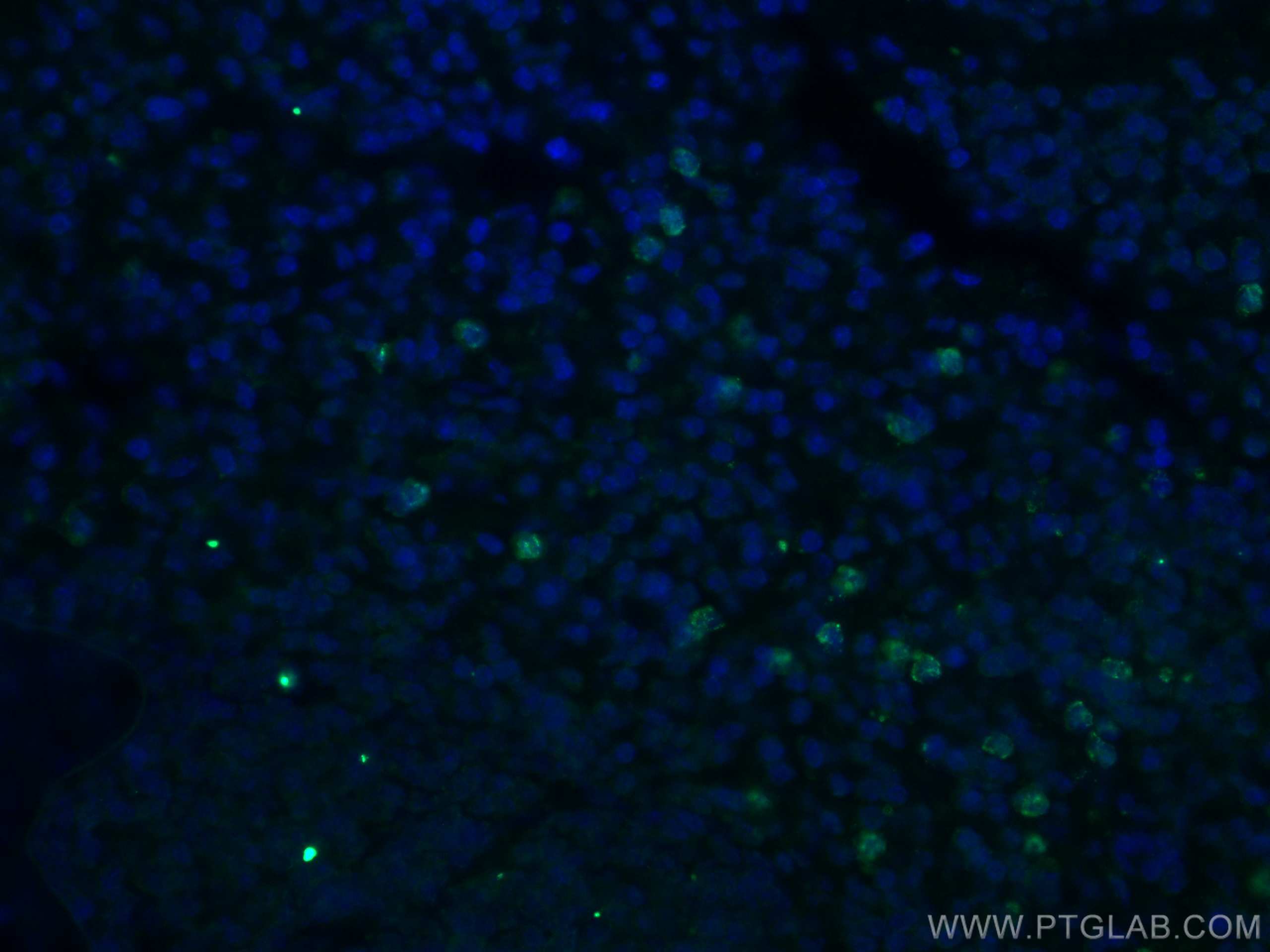 Immunofluorescence (IF) / fluorescent staining of mouse spleen tissue using IL-17a Polyclonal antibody (26163-1-AP)