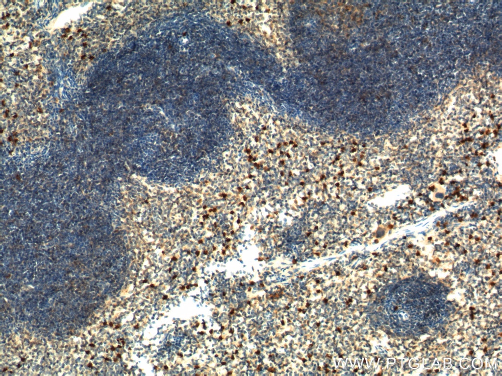 Immunohistochemistry (IHC) staining of mouse spleen tissue using IL-17a Polyclonal antibody (26163-1-AP)