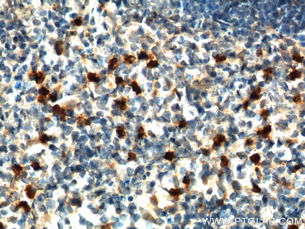 Immunohistochemistry (IHC) staining of mouse spleen tissue using IL-17a Polyclonal antibody (26163-1-AP)