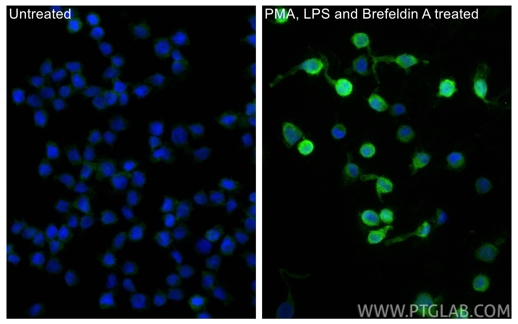 Immunofluorescence (IF) / fluorescent staining of THP-1 cells using IL-1 beta Polyclonal antibody (26048-1-AP)