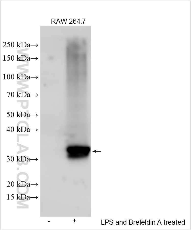 Western Blot (WB) analysis of various lysates using IL-1 beta Polyclonal antibody (26048-1-AP)