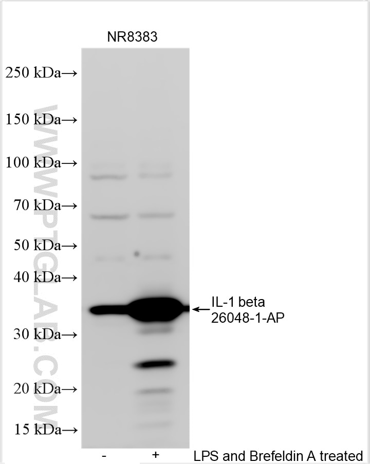 Western Blot (WB) analysis of various lysates using IL-1 beta Polyclonal antibody (26048-1-AP)