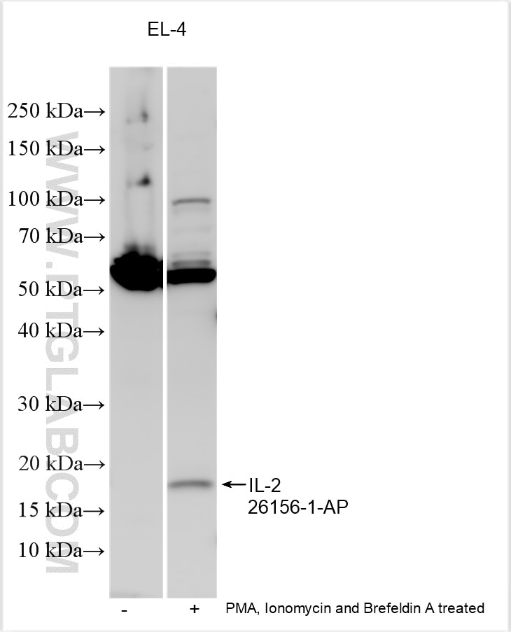 Western Blot (WB) analysis of various lysates using IL-2 Polyclonal antibody (26156-1-AP)