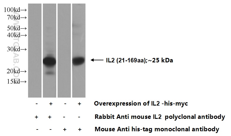 IL-2 Polyclonal antibody