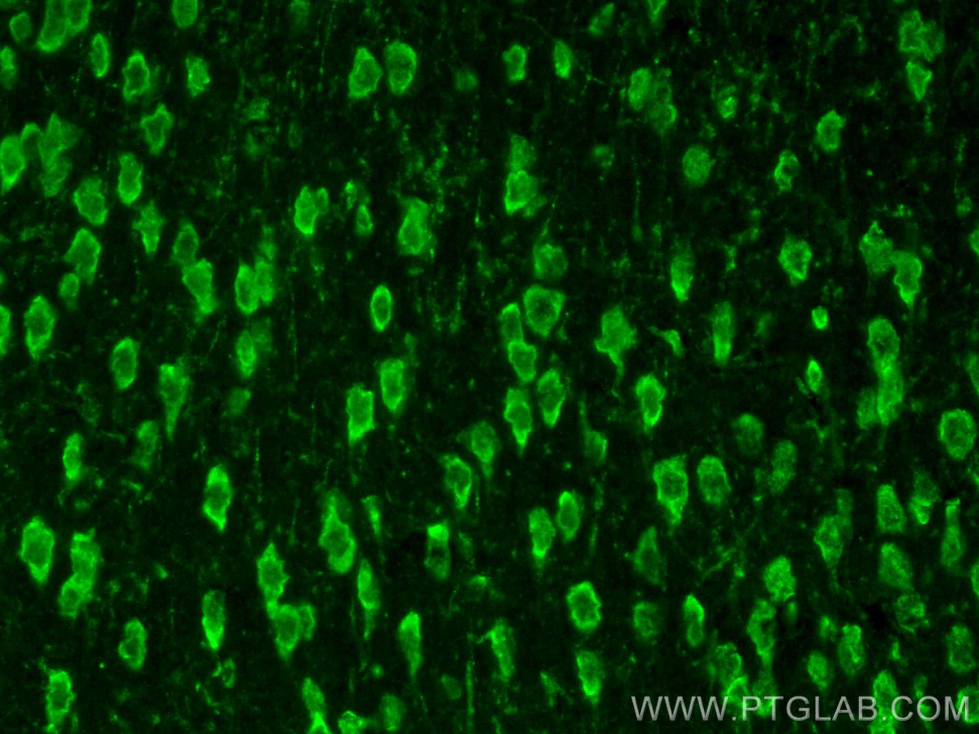 Immunofluorescence (IF) / fluorescent staining of mouse brain tissue using Il3ra Polyclonal antibody (30012-1-AP)