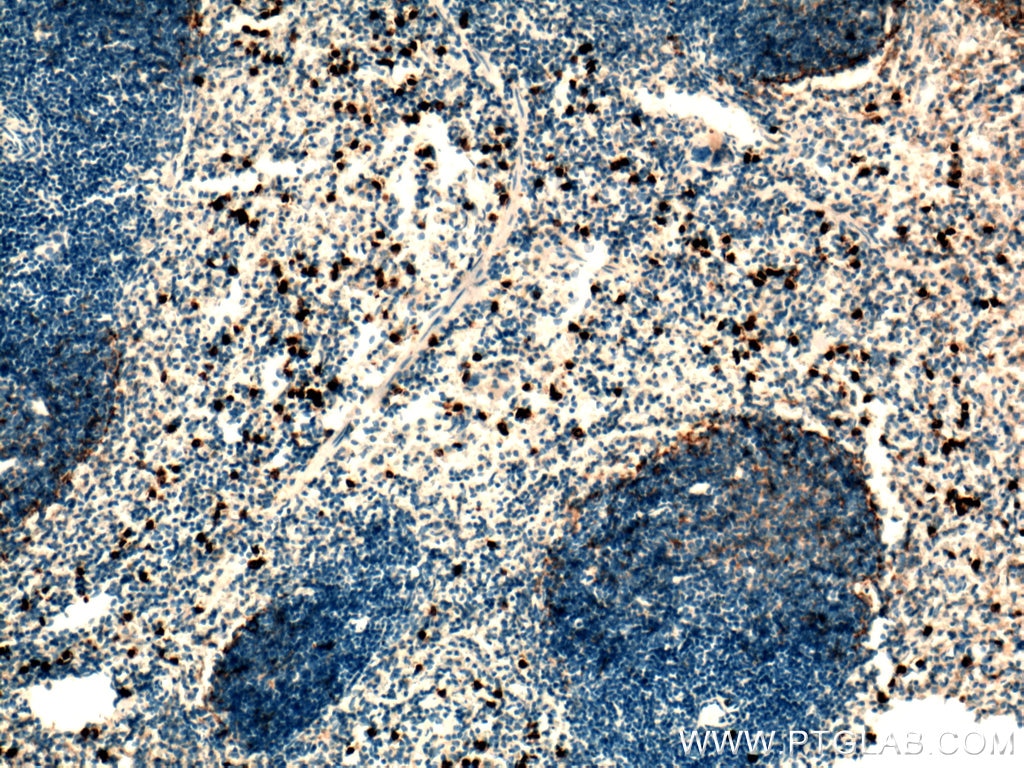 Immunohistochemistry (IHC) staining of mouse spleen tissue using Cxcr2-Specific Polyclonal antibody (19538-1-AP)