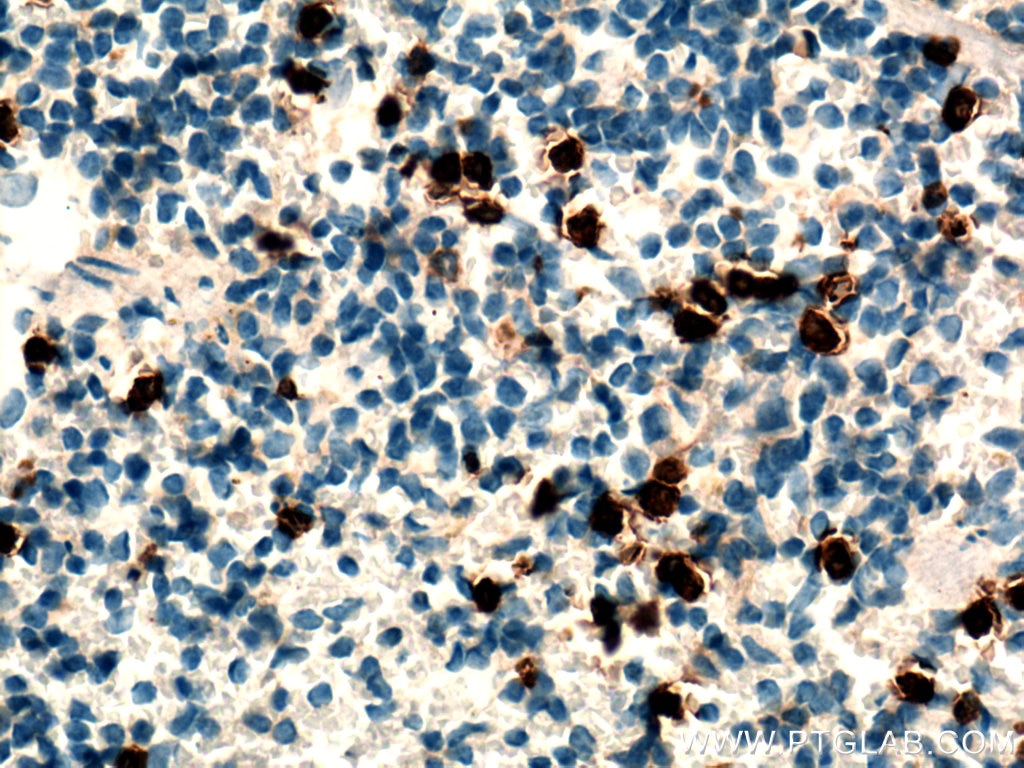 Immunohistochemistry (IHC) staining of mouse spleen tissue using Cxcr2-Specific Polyclonal antibody (19538-1-AP)