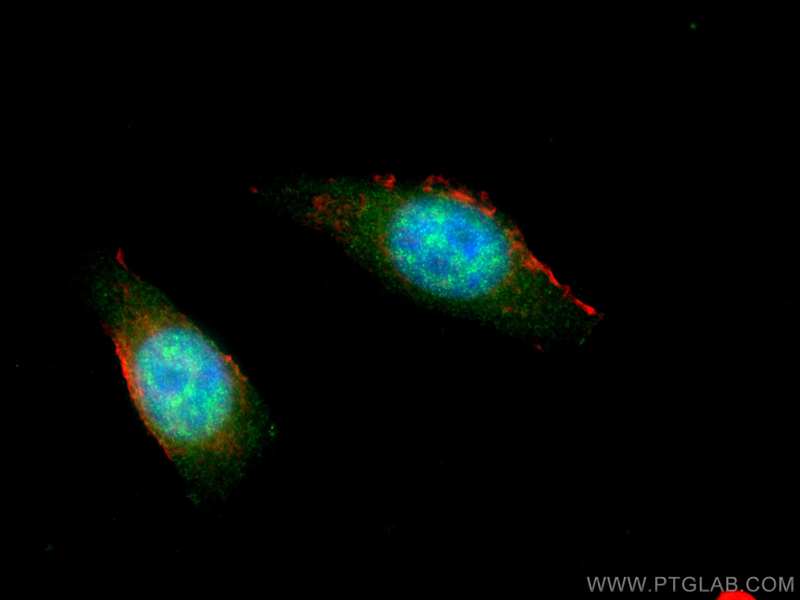 IF Staining of MCF-7 using 67897-1-Ig