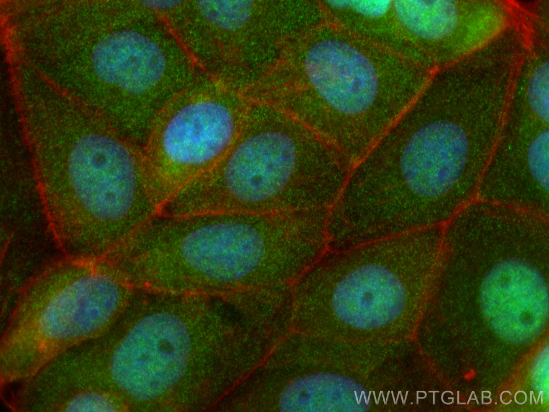 Immunofluorescence (IF) / fluorescent staining of MCF-7 cells using Importin Alpha 5 Monoclonal antibody (67897-1-Ig)