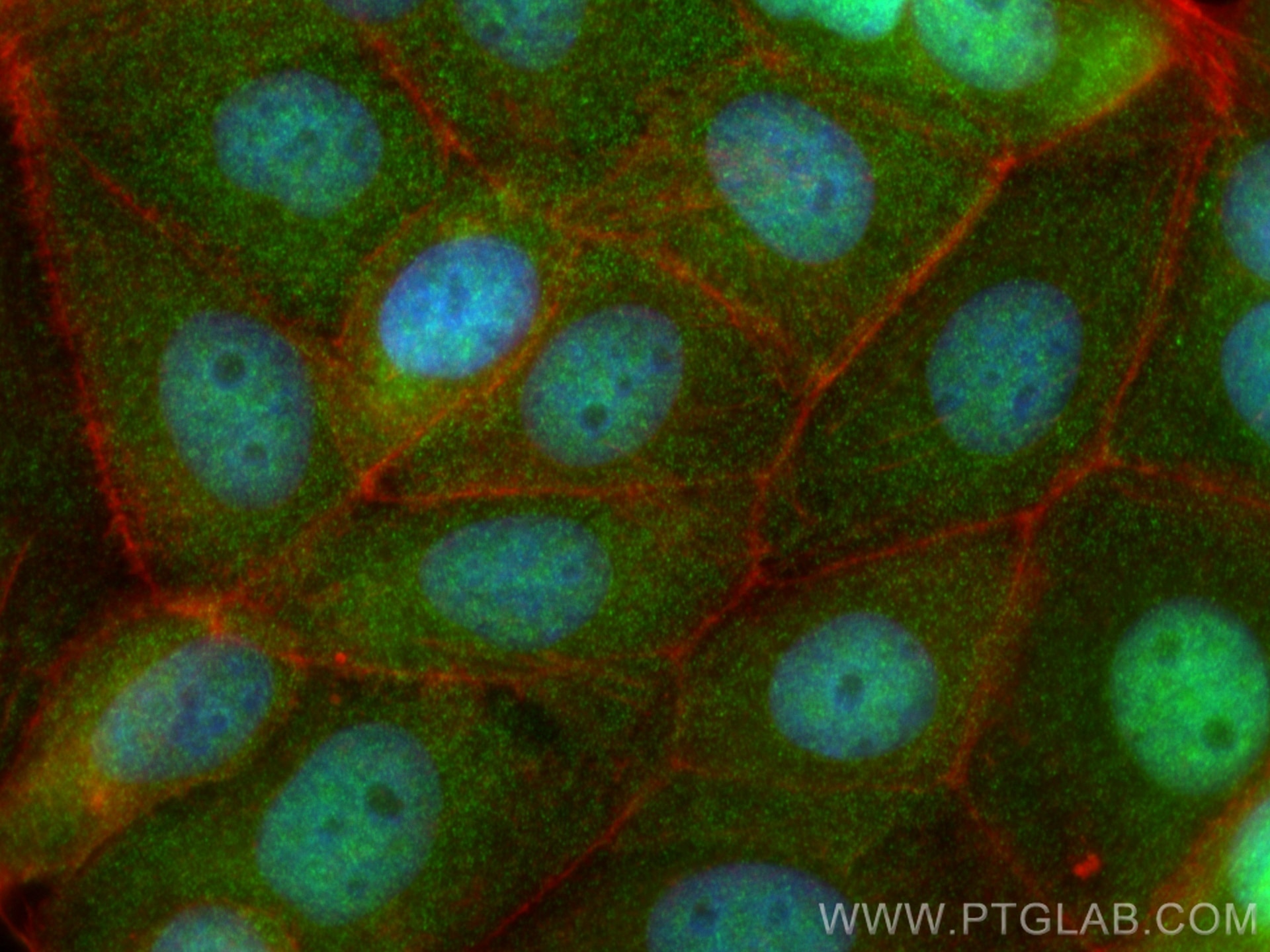 IF Staining of MCF-7 using 67897-1-Ig