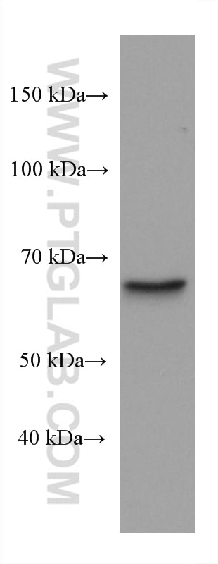 Western Blot (WB) analysis of 4T1 cells using Importin Alpha 5 Monoclonal antibody (67897-1-Ig)