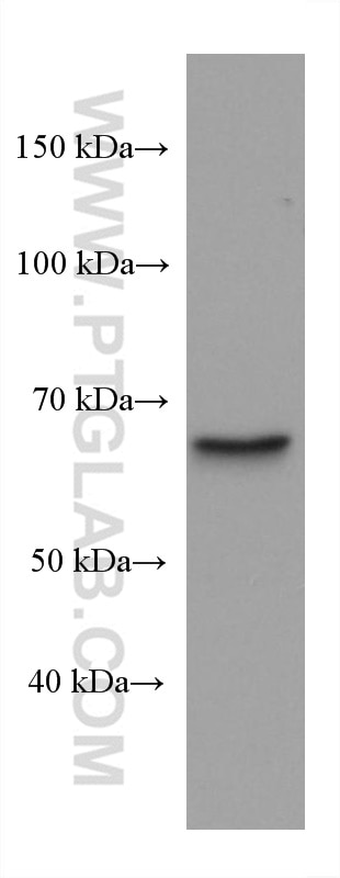 WB analysis of 4T1 using 67897-1-Ig