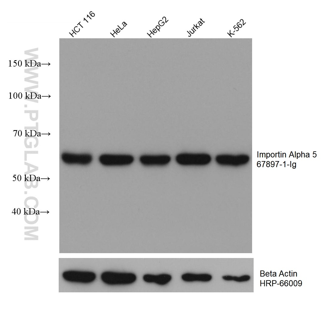 Western Blot (WB) analysis of various lysates using Importin Alpha 5 Monoclonal antibody (67897-1-Ig)