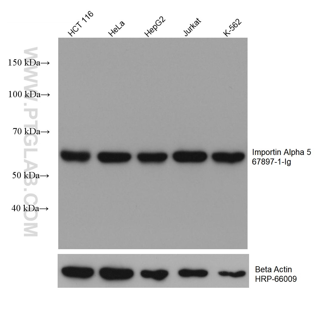 WB analysis using 67897-1-Ig