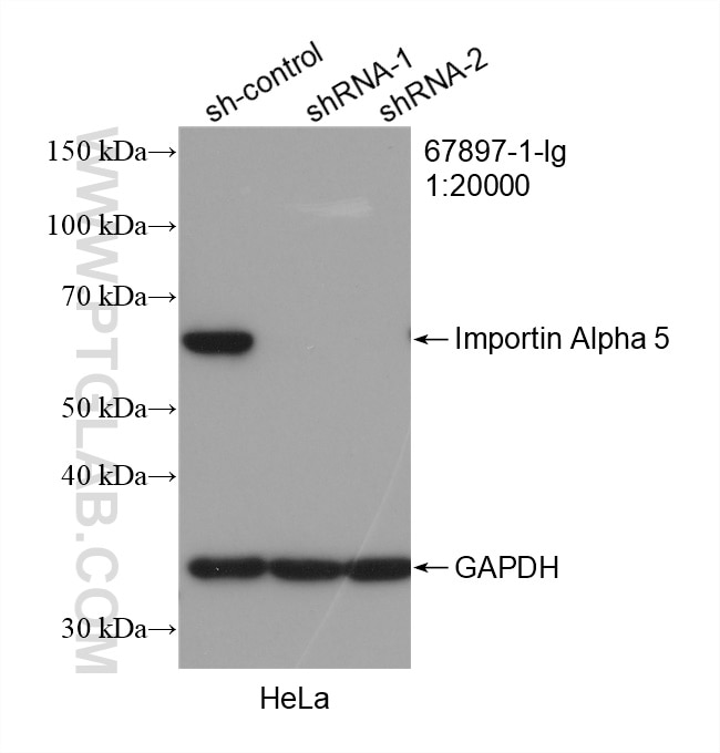 Western Blot (WB) analysis of HeLa cells using Importin Alpha 5 Monoclonal antibody (67897-1-Ig)