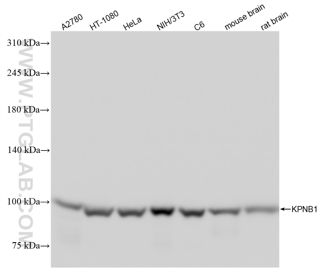 Western Blot (WB) analysis of various lysates using Importin Beta Recombinant monoclonal antibody (86630-3-RR)