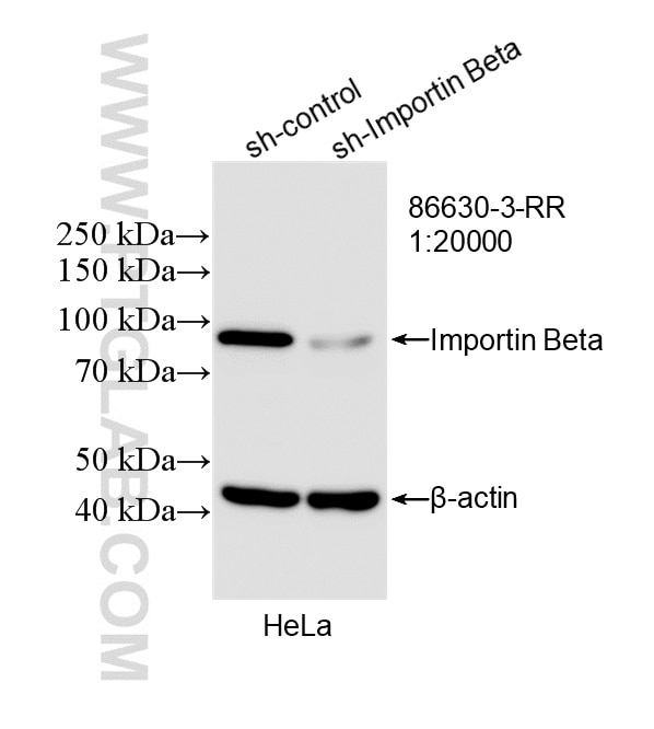 Western Blot (WB) analysis of HeLa cells using Importin Beta Recombinant monoclonal antibody (86630-3-RR)