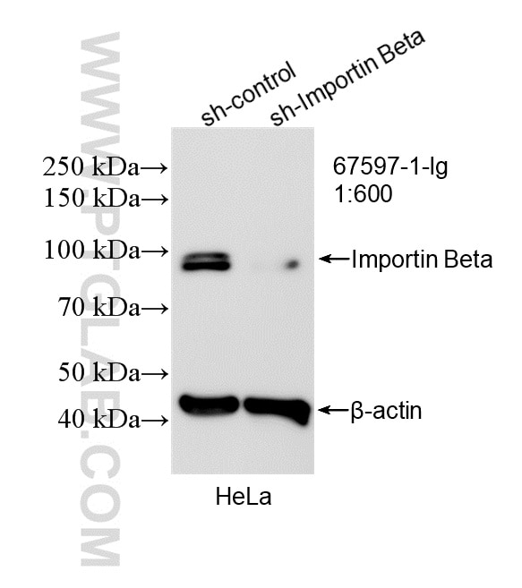 Western Blot (WB) analysis of HeLa cells using Importin Beta Monoclonal antibody (67597-1-Ig)