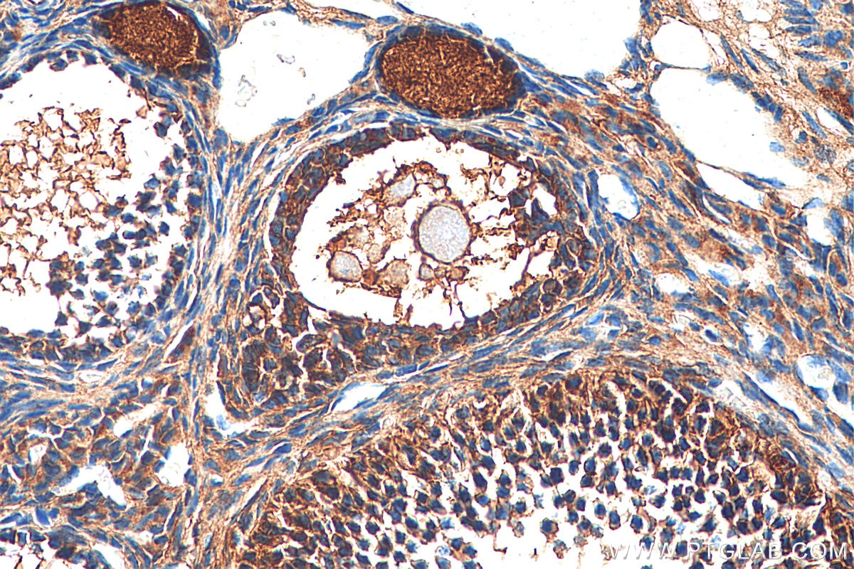 Immunohistochemistry (IHC) staining of mouse ovary tissue using Inhibin alpha Polyclonal antibody (27331-1-AP)