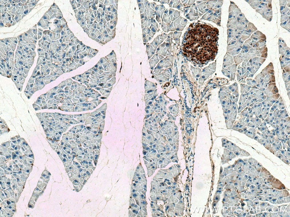 IHC staining of mouse pancreas using 67668-1-Ig