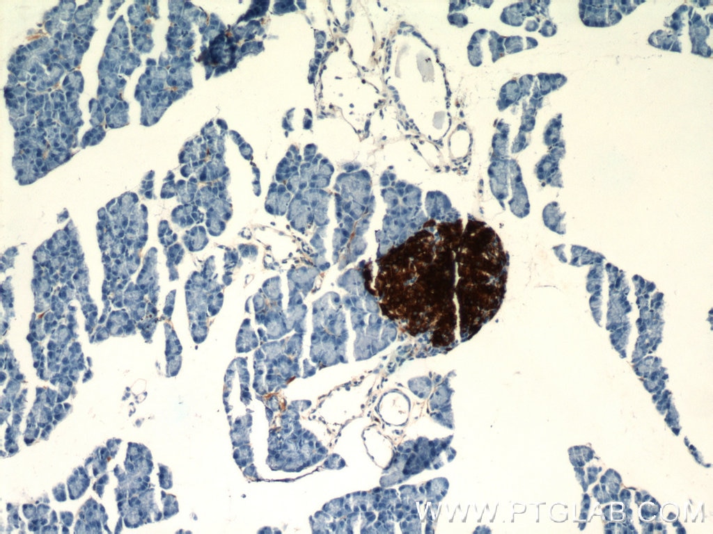 IHC staining of mouse pancreas using 66198-1-Ig