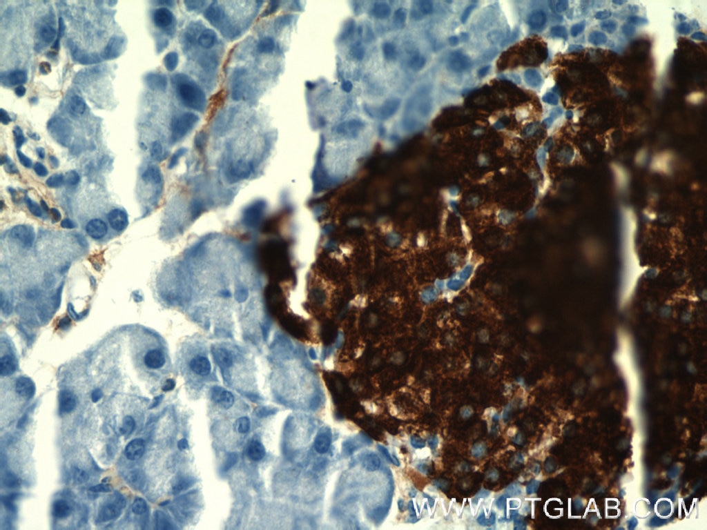 IHC staining of mouse pancreas using 66198-1-Ig