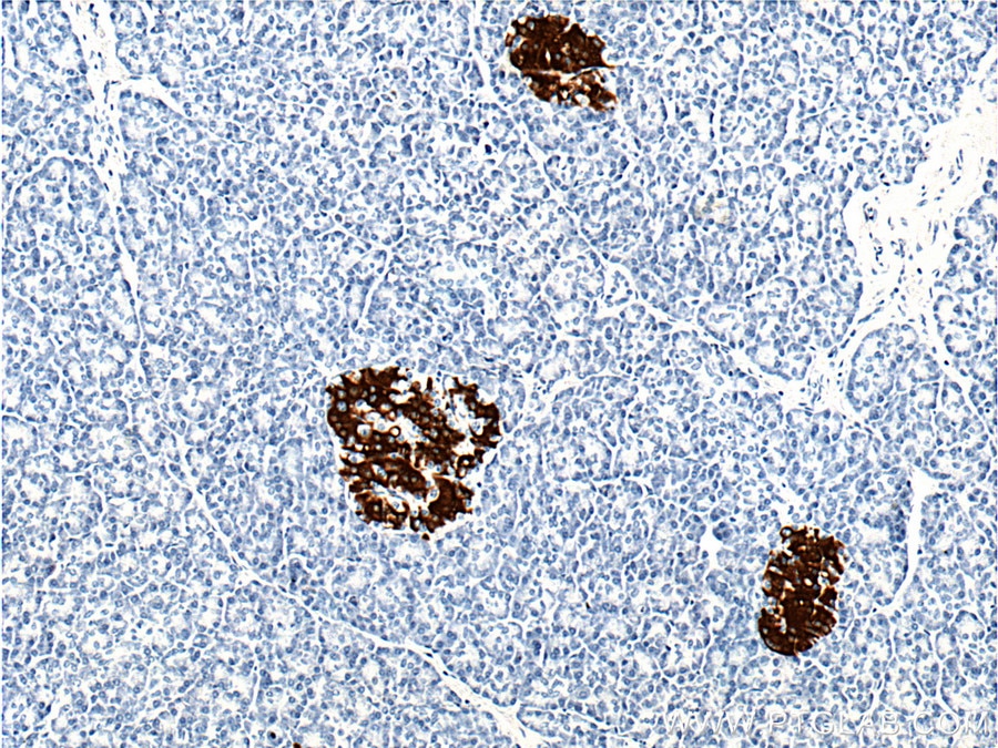 Immunohistochemistry (IHC) staining of human pancreas tissue using INS Monoclonal antibody (66198-1-Ig)