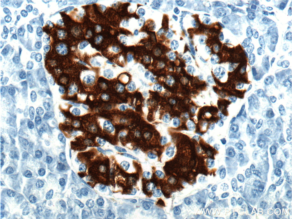 Immunohistochemistry (IHC) staining of human pancreas tissue using INS Monoclonal antibody (66198-1-Ig)