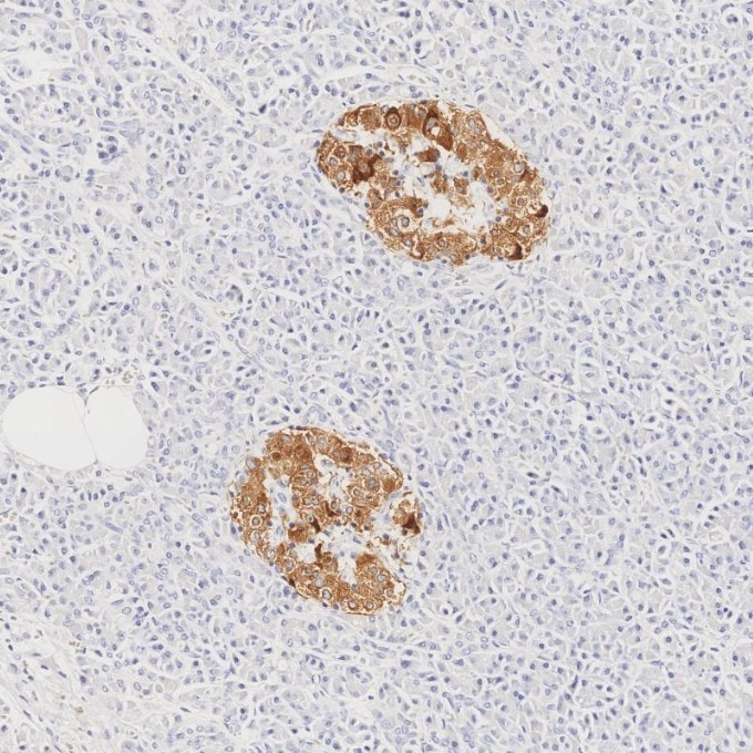 IHC staining of human pancreas using 66198-1-Ig Immunohistochemistry (IHC) staining of human pancreas tissue using INS Monoclonal antibody (66198-1-Ig)