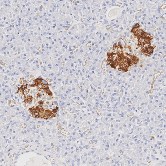 IHC staining of human pancreas using 66198-1-Ig Immunohistochemistry (IHC) staining of human pancreas tissue using INS Monoclonal antibody (66198-1-Ig)