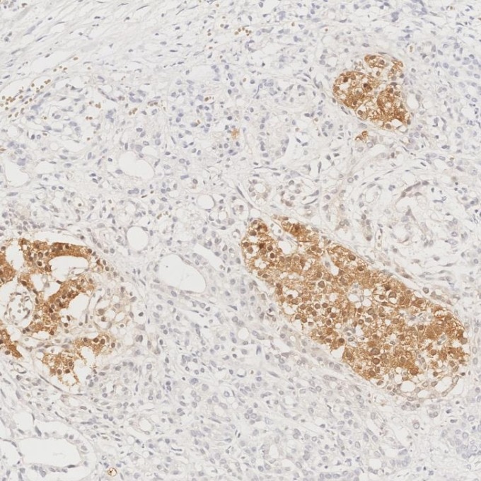 IHC staining of human pancreas using 66198-1-Ig Immunohistochemistry (IHC) staining of human pancreas tissue using INS Monoclonal antibody (66198-1-Ig)