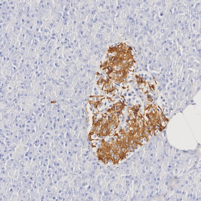 IHC staining of human pancreas using 66198-1-Ig Immunohistochemistry (IHC) staining of human pancreas tissue using INS Monoclonal antibody (66198-1-Ig)