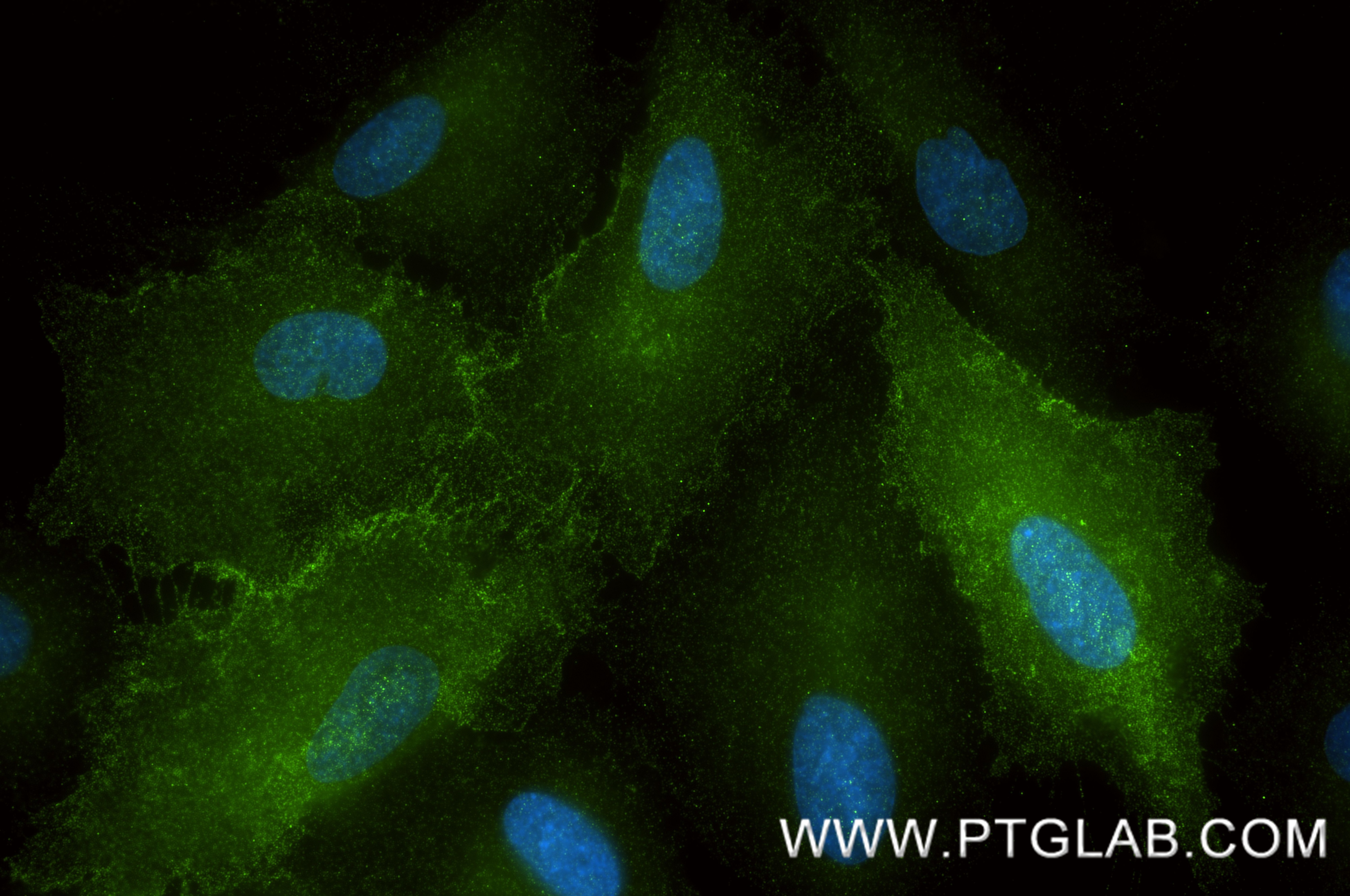 IF Staining of A549 using 88169-1-RR (same clone as 88169-1-PBS) Immunofluorescence (IF) / fluorescent staining of A549 cells using Integrin Alpha 3 Recombinant monoclonal antibody (88169-1-RR)