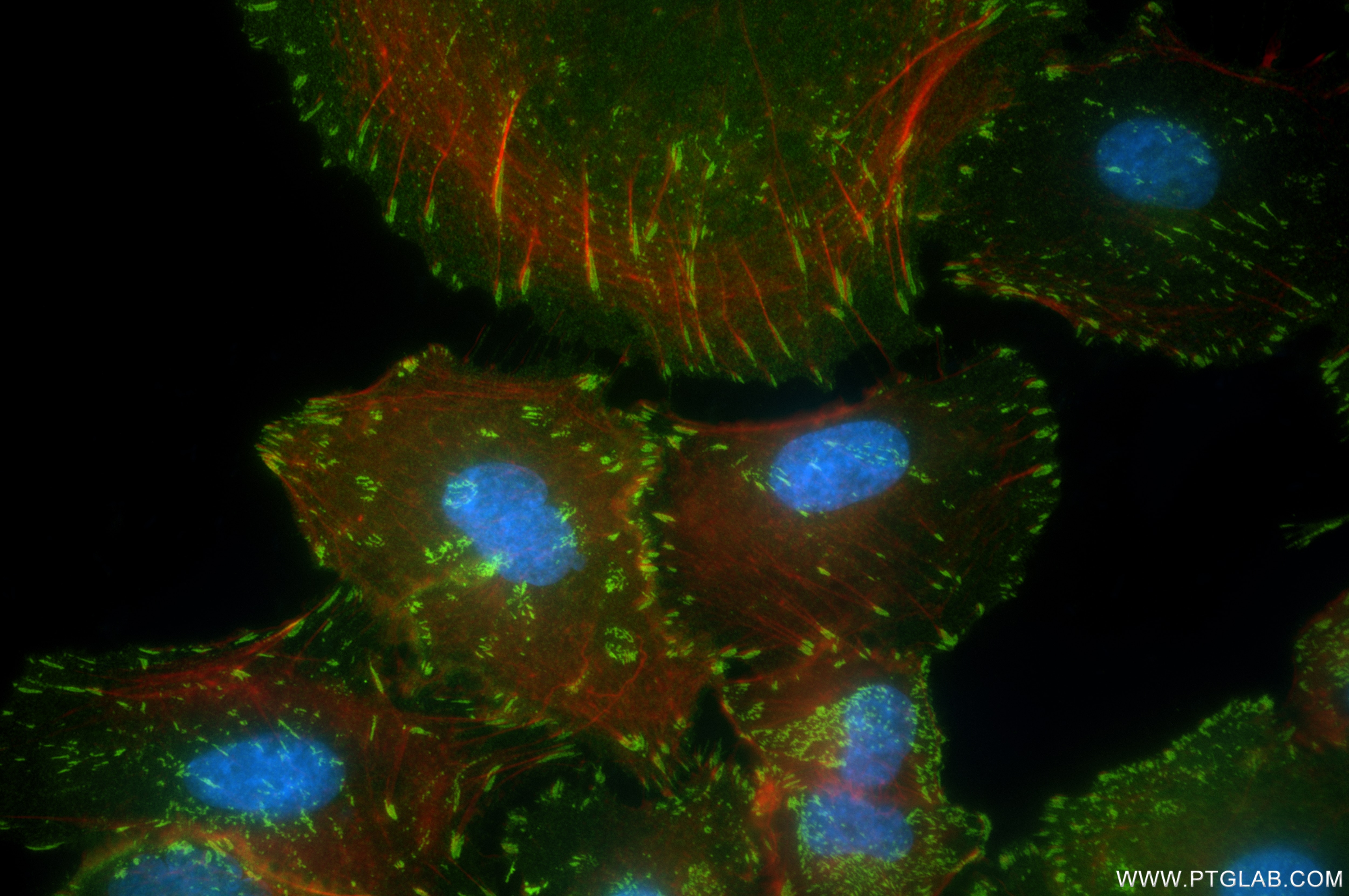 Immunofluorescence (IF) / fluorescent staining of A549 cells using Integrin Alpha V Recombinant antibody (84883-5-RR)