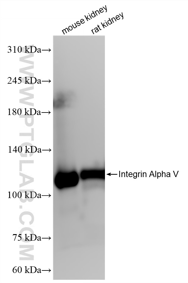 Western Blot (WB) analysis of various lysates using Integrin Alpha V Recombinant monoclonal antibody (84883-5-RR)