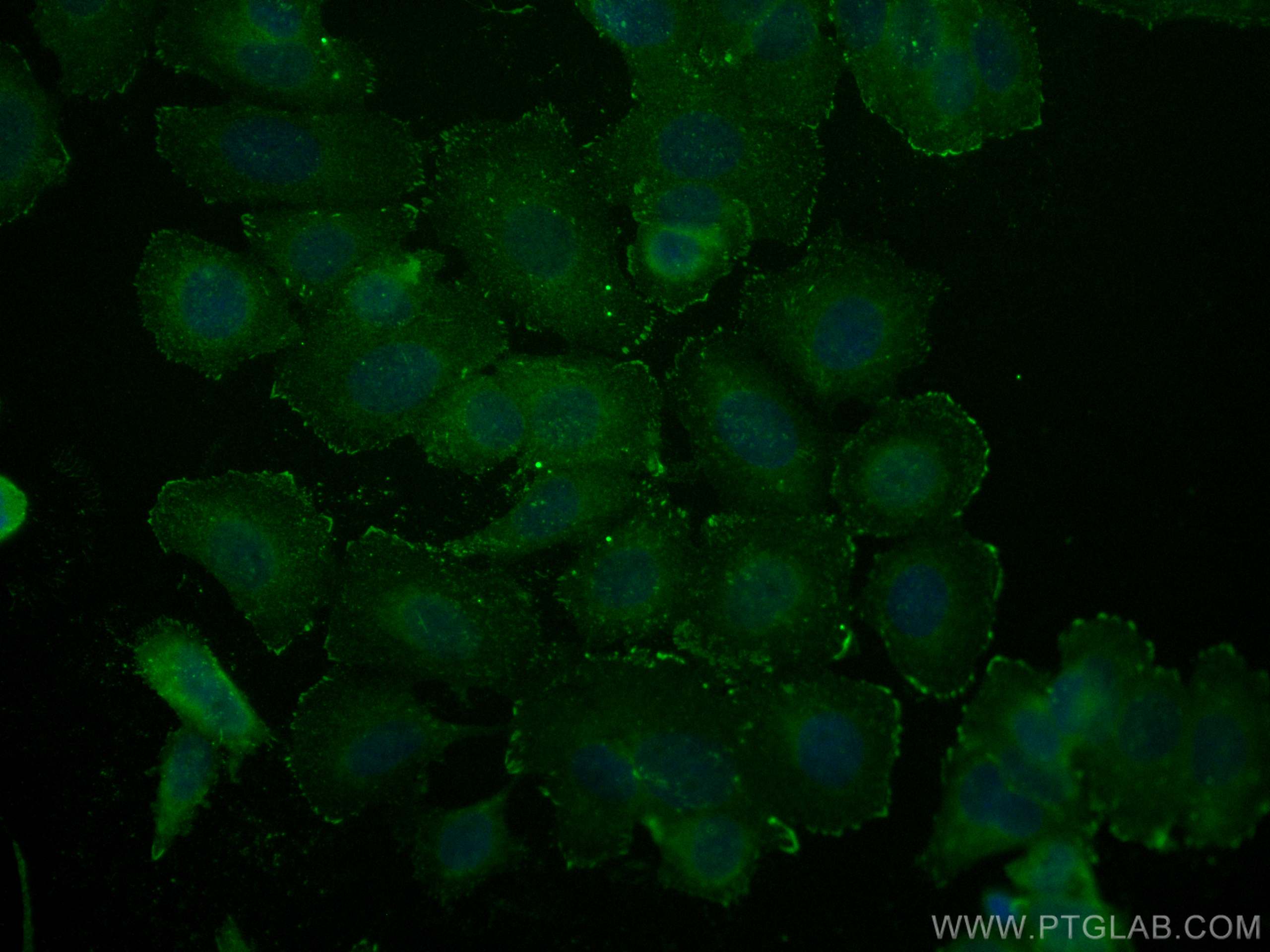 Immunofluorescence (IF) / fluorescent staining of MCF-7 cells using CoraLite® Plus 488-conjugated Integrin Alpha V Pol (CL488-27096)