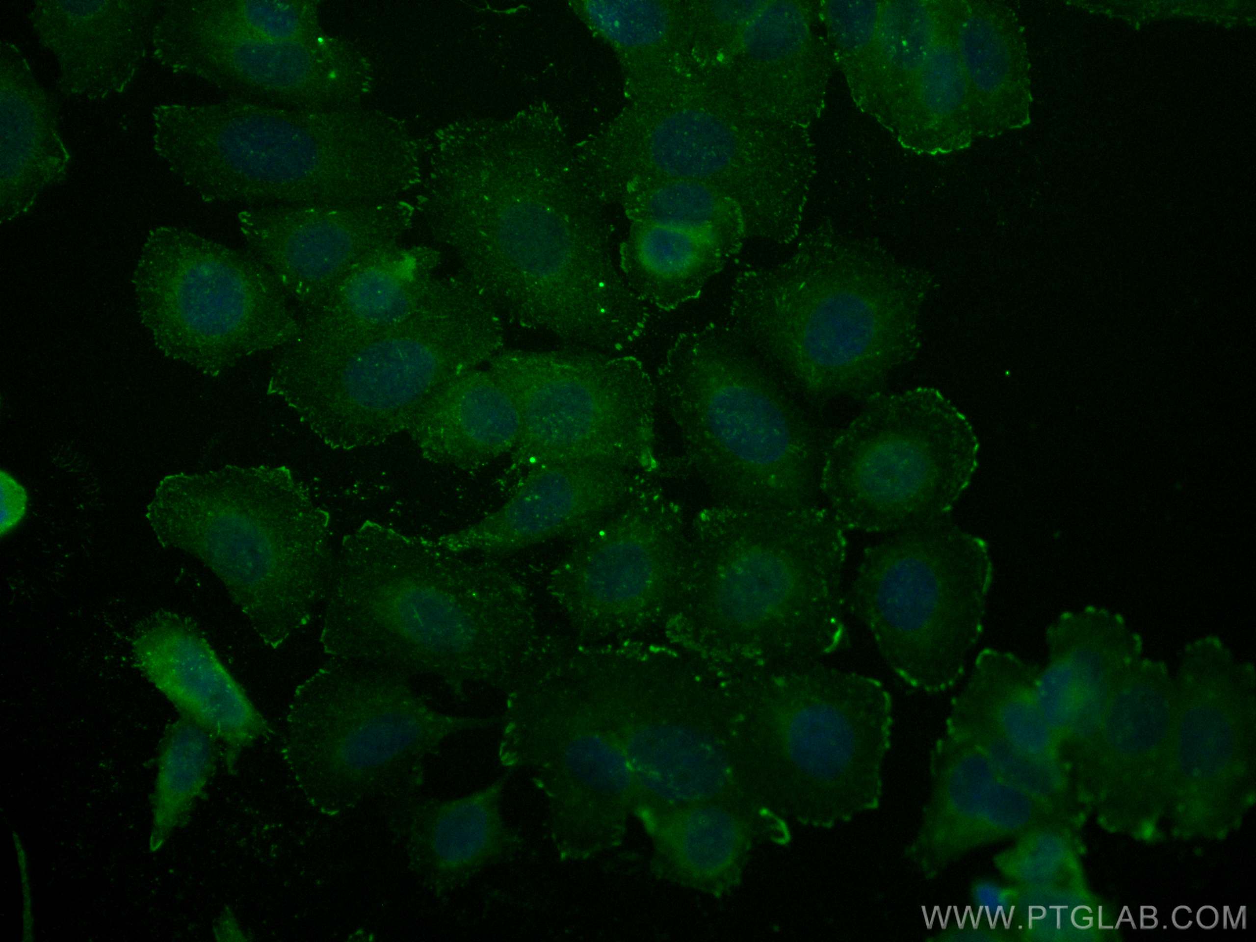 Integrin Alpha V