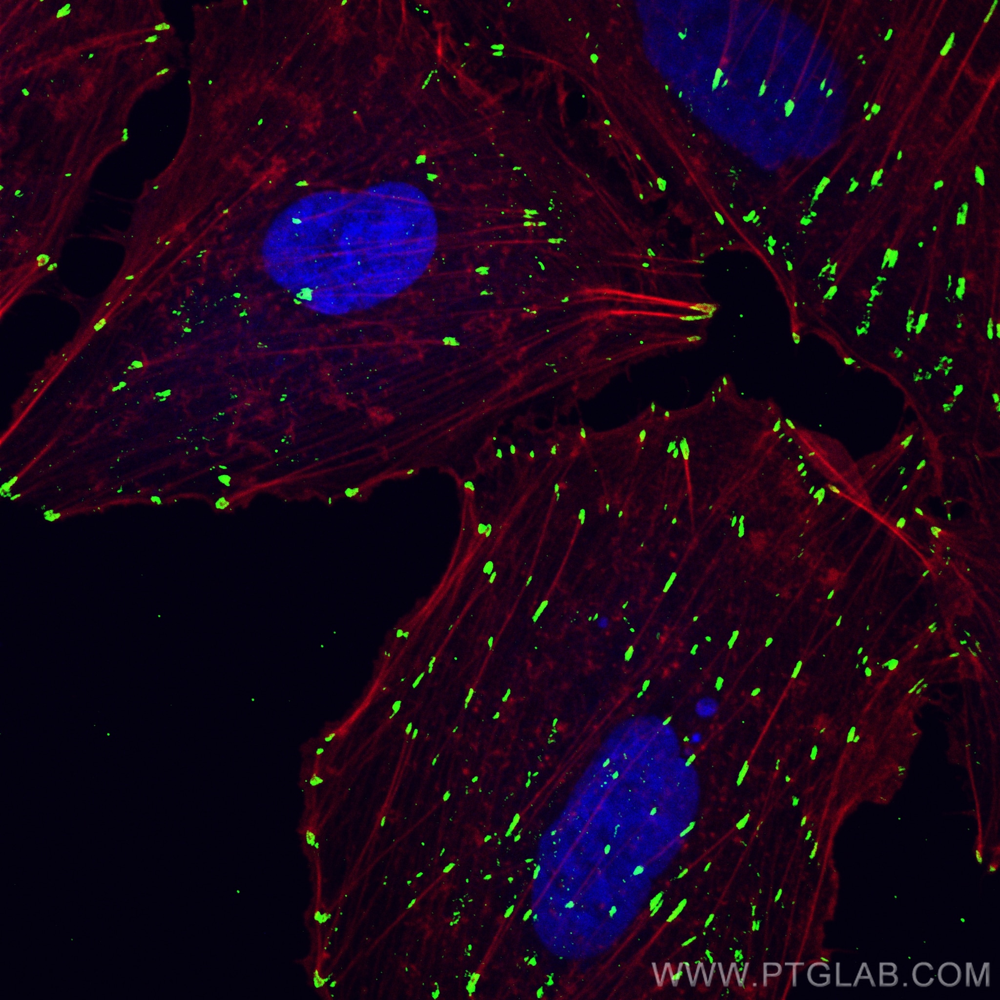 Immunofluorescence (IF) / fluorescent staining of A549 cells using CoraLite® Plus 488-conjugated Integrin Alpha V Pol (CL488-27096)