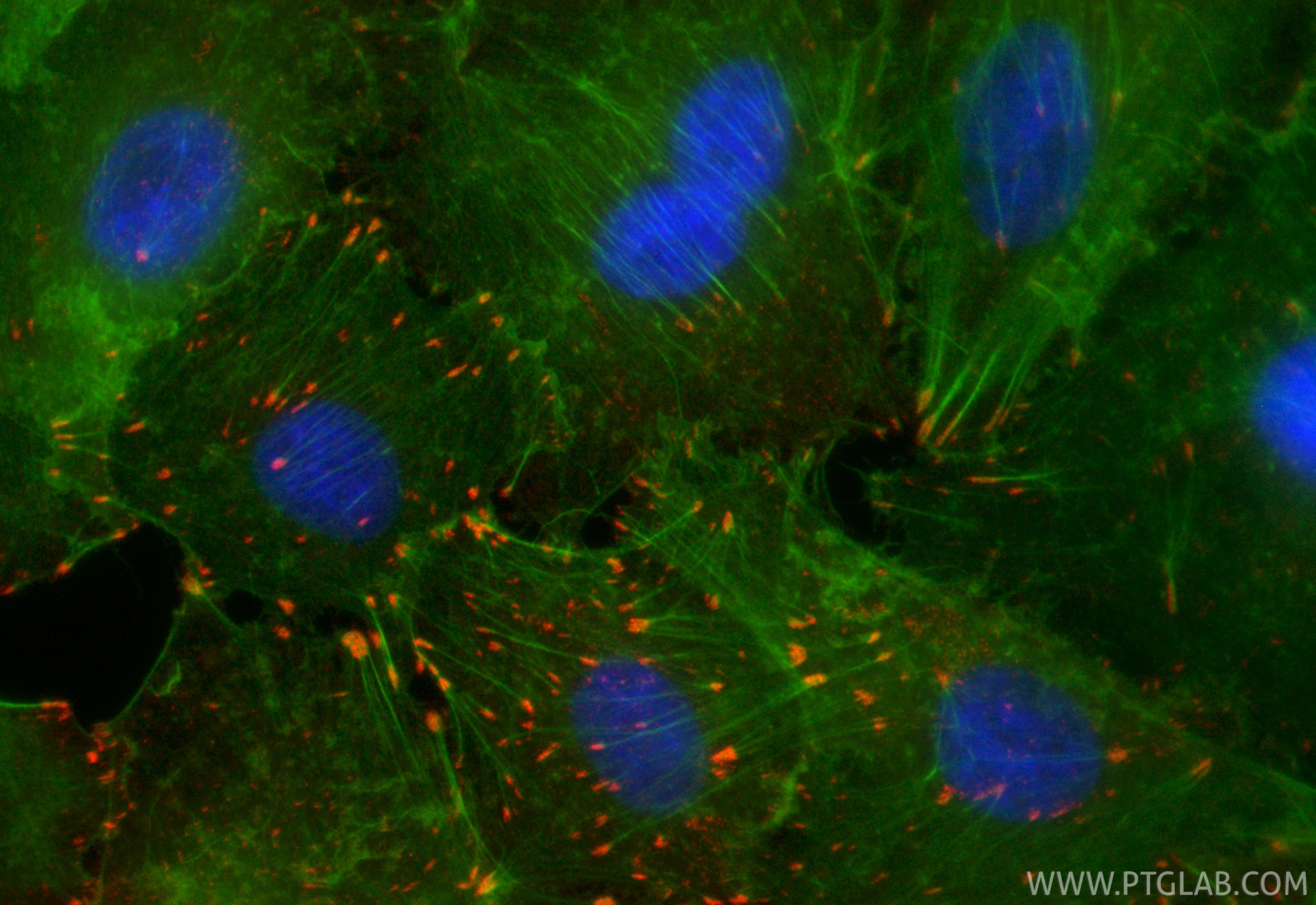 Immunofluorescence (IF) / fluorescent staining of A549 cells using CoraLite®594-conjugated Integrin Alpha V Recombina (CL594-84883-5)