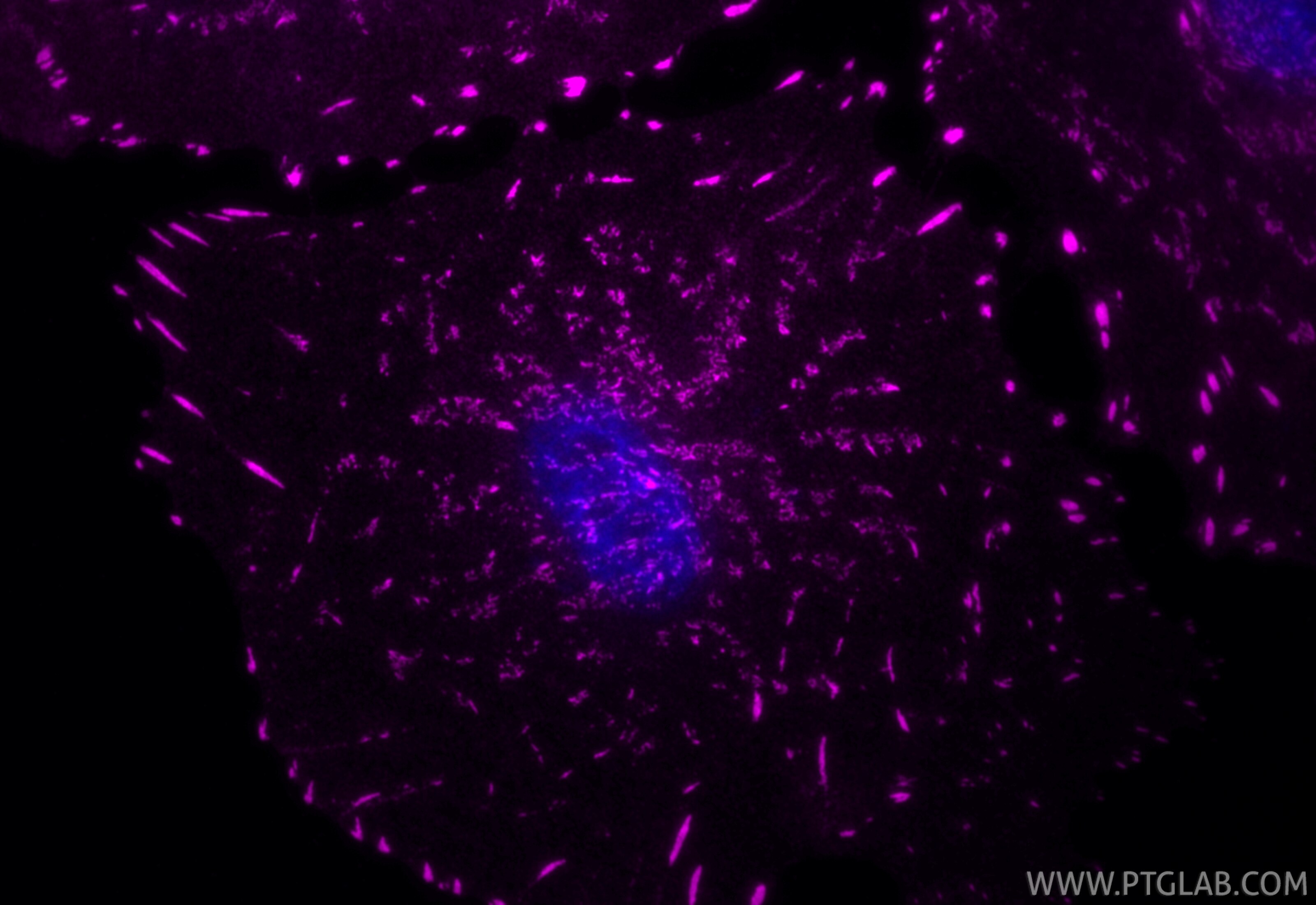Immunofluorescence (IF) / fluorescent staining of A549 cells using CoraLite® Plus 647-conjugated Integrin Alpha V Rec (CL647-84883-5)