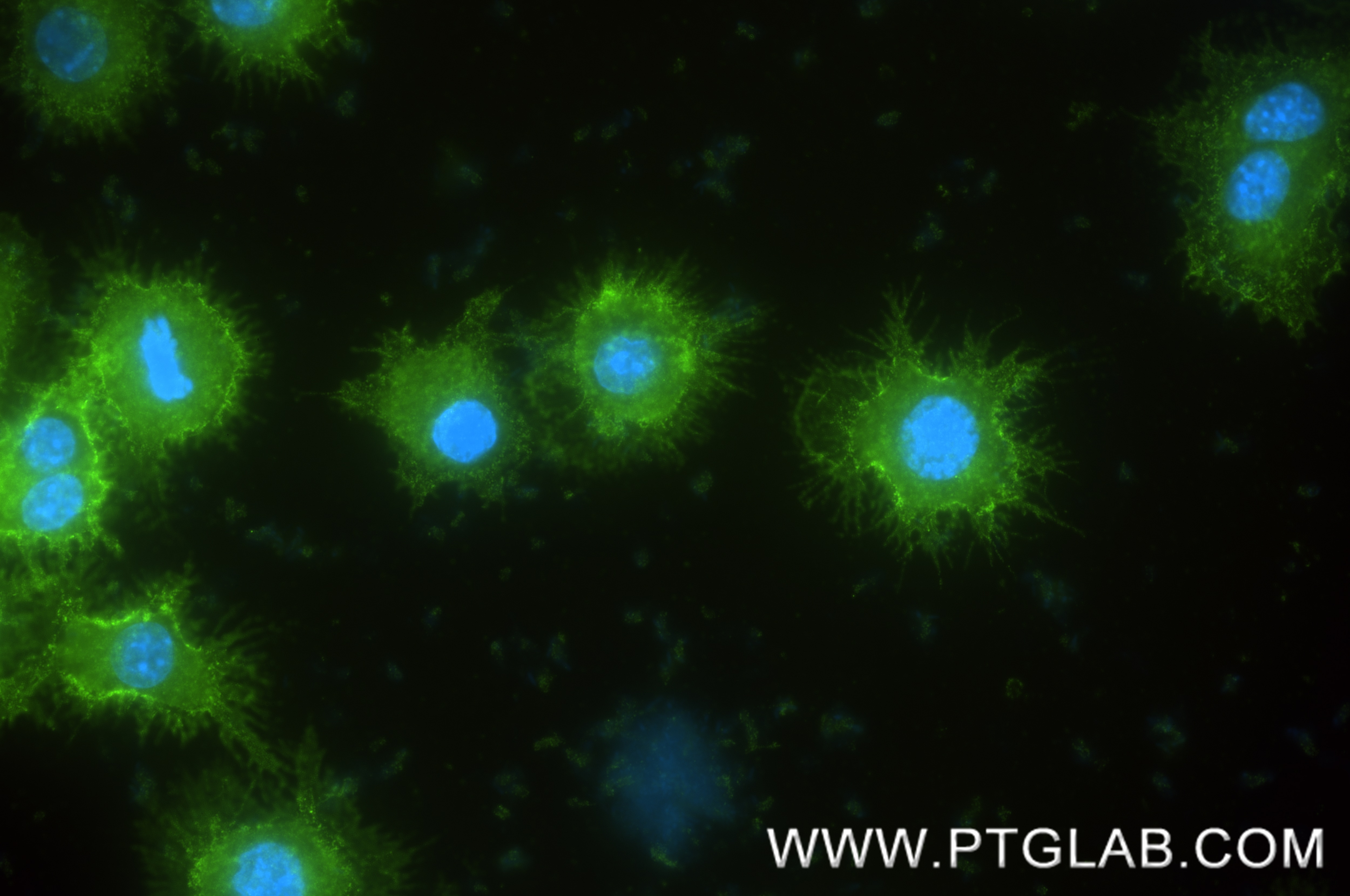 IF Staining of RAW 264.7 using 87495-1-RR (same clone as 87495-1-PBS) Immunofluorescence (IF) / fluorescent staining of RAW 264.7 cells using Integrin Beta 1/CD29 Recombinant monoclonal antibo (87495-1-RR)