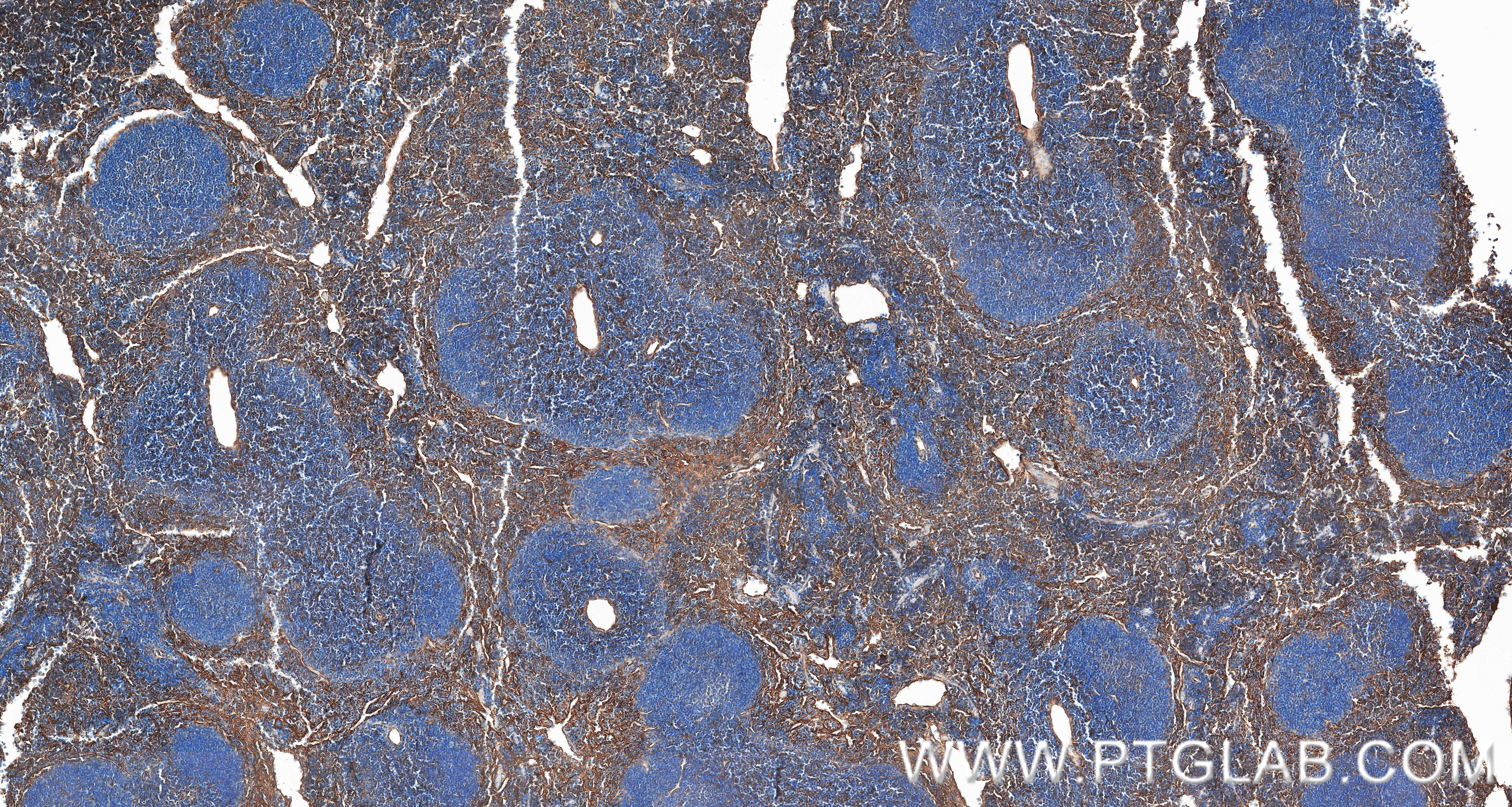IHC staining of mouse spleen using 87495-1-RR (same clone as 87495-1-PBS) Immunohistochemistry (IHC) staining of mouse spleen tissue using Integrin Beta 1/CD29 Recombinant monoclonal antibo (87495-1-RR)