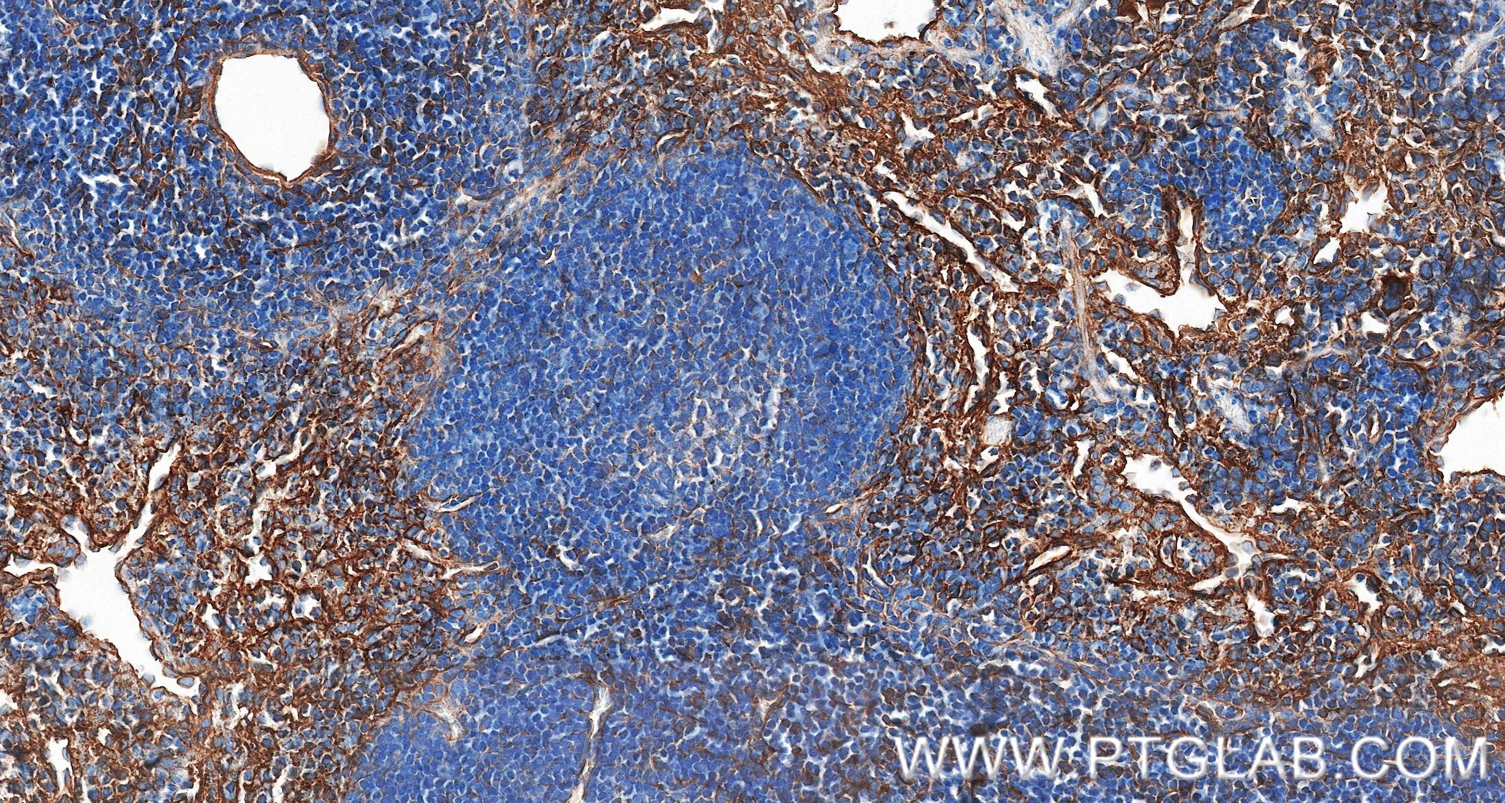 IHC staining of mouse spleen using 87495-1-RR (same clone as 87495-1-PBS) Immunohistochemistry (IHC) staining of mouse spleen tissue using Integrin Beta 1/CD29 Recombinant monoclonal antibo (87495-1-RR)